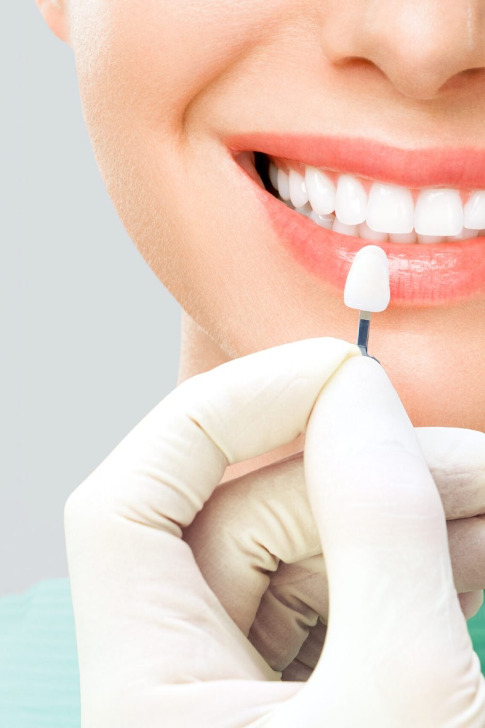 verifique-seleccione-color-dientes-blanqueamiento-dientes-scaled.jpg